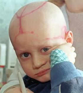 Нажмите на изображение для увеличения.

Название:	Leukemia%u00252Band%2BChildren.jpg
Просмотров:	1
Размер:	11.5 Кб
ID:	10129416