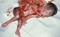 Нажмите на изображение для увеличения.

Название:	abortion_22_weeks.jpg
Просмотров:	15
Размер:	31.4 Кб
ID:	10129630